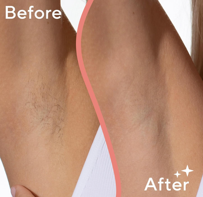 Finishing Touch Flawless Underarm Hair Removal Electric Razor for Women