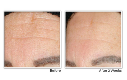 RoC Anti-Aging Sulfate Free Facial Cleanser with Vitamin C + Glycolic Acid - 6.0 fl oz